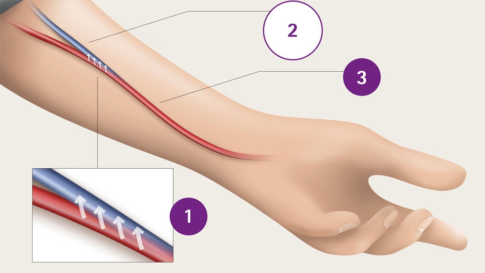 Diagramm der Blutgefäße des Arms, eindeutig gekennzeichnet, um Arterien, Venen und Kapillaren zu Bildungszwecken zu identifizieren.